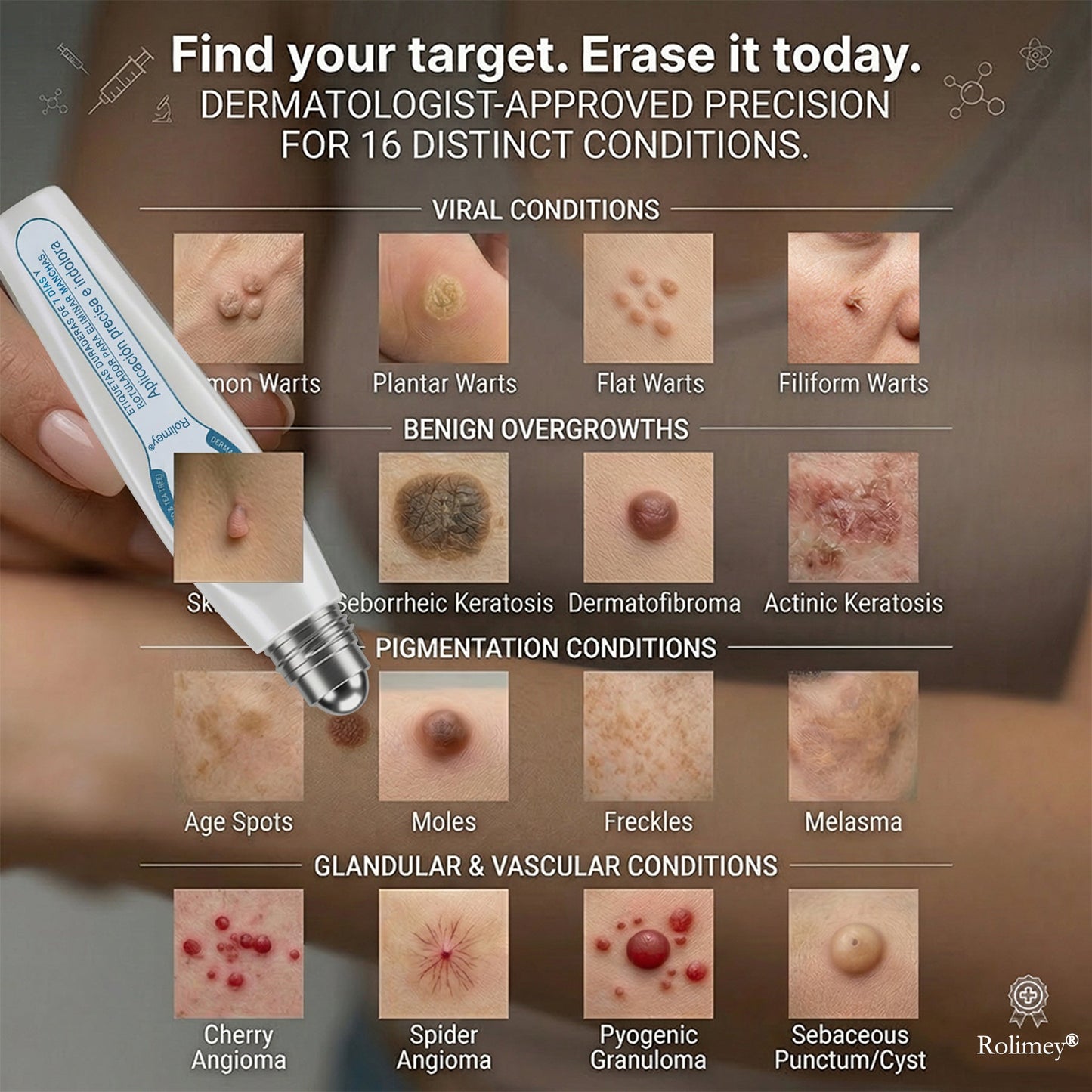 ✨ Official UK Store | Natravor® 7-Day Skin Tag & Blemish Roll-On – Painless & Scar-Free